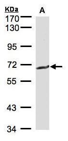 GGT1 Rabbit Polyclonal Antibody