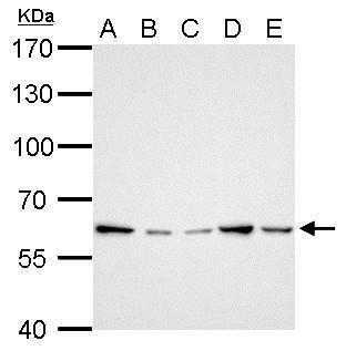 GGT1 Rabbit Polyclonal Antibody