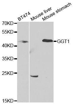 GGT1 antibody