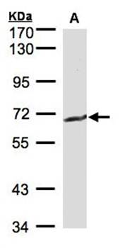 gamma-glutamyltransferase 1 precursor antibody
