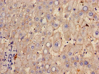 GGT1 Antibody