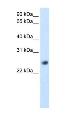 GGTLC1 antibody