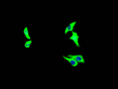 GHR Recombinant Monoclonal Antibody