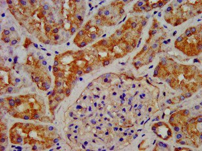 GHRHR antibody