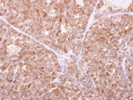 GILT Rabbit Polyclonal Antibody