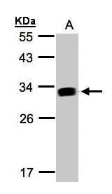 GILT Rabbit Polyclonal Antibody