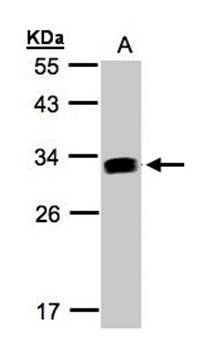 GILT antibody