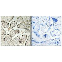 GIMAP5 Antibody