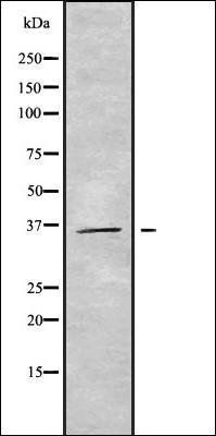 GIMAP7 antibody