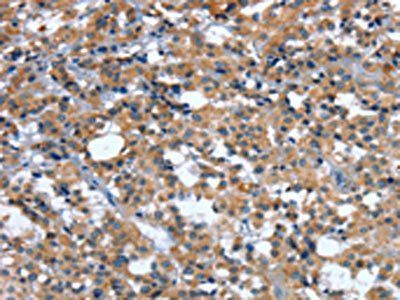 GINS1 Antibody