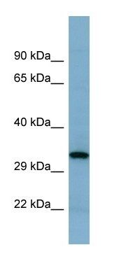 GINS4 Antibody