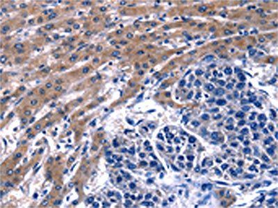 GIP Antibody