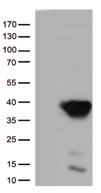 GIPC (GIPC1) antibody