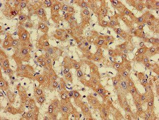 GIPC1 Antibody
