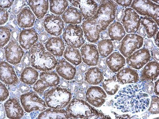 GIPC1 Rabbit Polyclonal Antibody