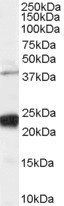 Goat anti-GIPC1 / NIP Antibody