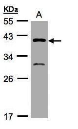 GIPC3 antibody