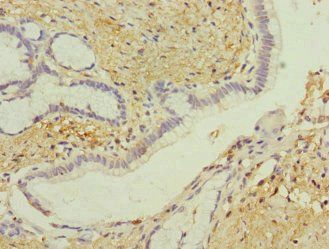 GIPR Antibody