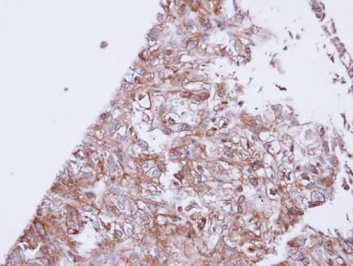 GIRK1 Rabbit Polyclonal Antibody