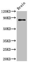 GIT1 antibody