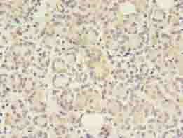 GIT2 Antibody