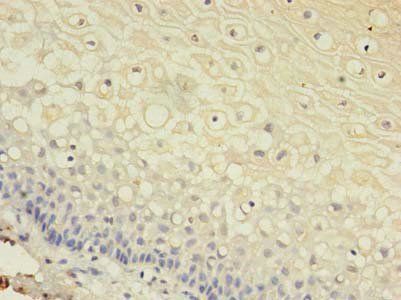 GJB3 Antibody