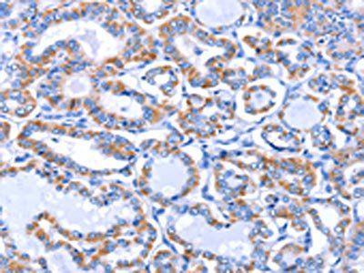 GJB3 antibody