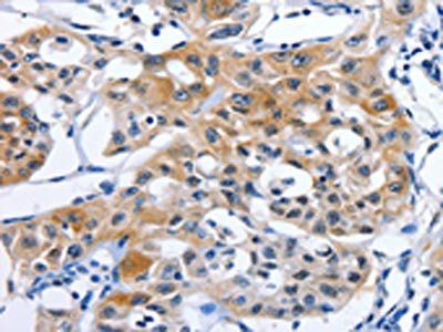 GJB3 Antibody