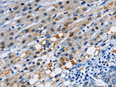 GJB3 Antibody