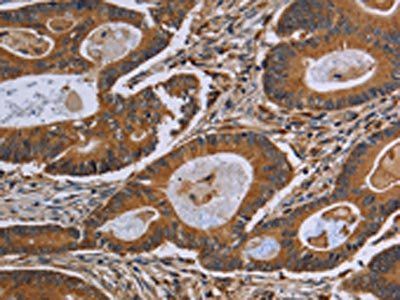 GJB4 Antibody