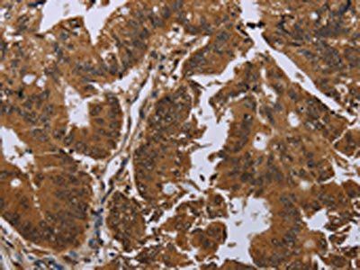 GJB4 Antibody
