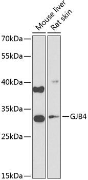 GJB4 antibody