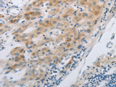 GJB6 Antibody