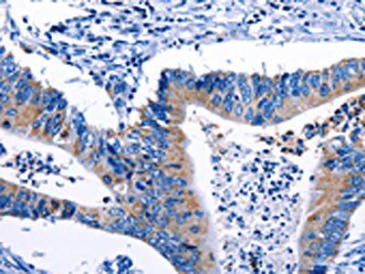 Gjc3 Antibody