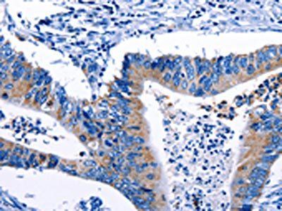 Gjc3 antibody