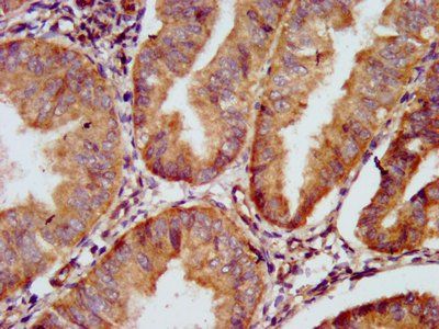 GJD2 Antibody