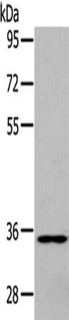 GJD2 Antibody