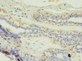 GK2 Antibody