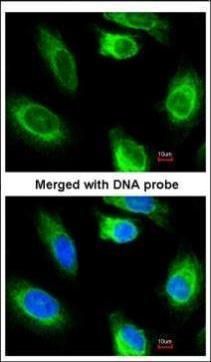 Glycerol kinase 2 antibody [N1C1]
