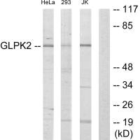 GK2 Antibody