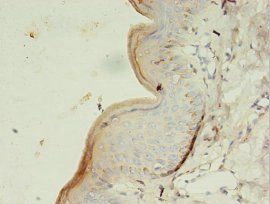 GK3P Antibody
