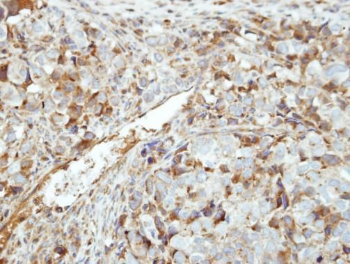 GK5 antibody