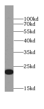 GKN1 antibody