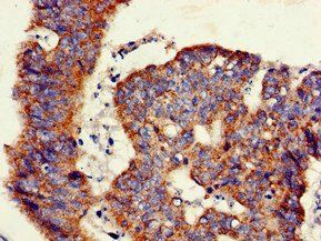 GLB1 Antibody
