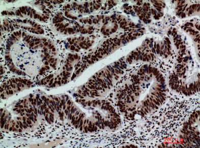 GLB1 Antibody