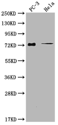 GLB1L3 antibody