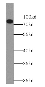 GLI2-Specific antibody