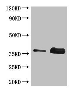 Gliadin antibody