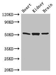 Glial fibrillary acidic protein antibody