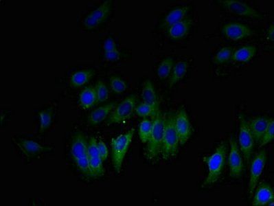 Glioma pathogenesis-related protein 1 antibody